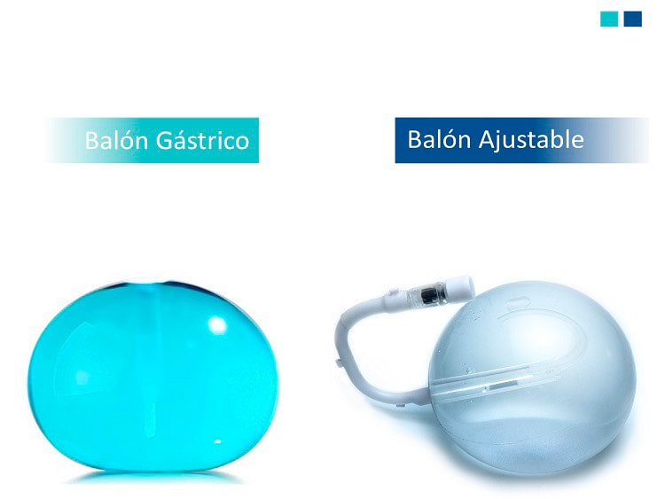 Diferencias entre Balón Intragástrico y Balón Ajustable