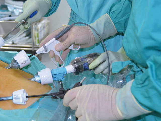 Laparoscopia: la técnica más empleada en Cirugía Bariátrica
